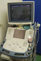 超音波診断装置
